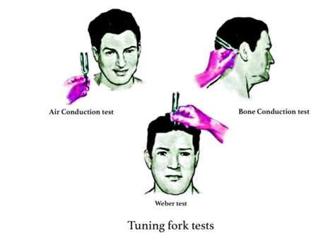 The use of the weber tuning fork test and 'scratch test' in 